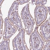 Anti-AMIGO2 antibody produced in rabbit Prestige Antibodies&#174; Powered by Atlas Antibodies, affinity isolated antibody, buffered aqueous glycerol solution