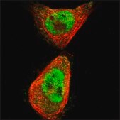 Anti-SLC29A1 antibody produced in rabbit Prestige Antibodies® Powered by Atlas Antibodies, affinity isolated antibody, buffered aqueous glycerol solution