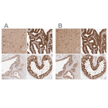 Anti-NUDC antibody produced in rabbit Prestige Antibodies&#174; Powered by Atlas Antibodies, affinity isolated antibody, buffered aqueous glycerol solution, ab2