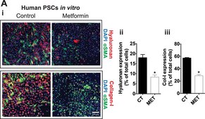 抗-肌动蛋白, α-平滑肌- Cy3™抗体，小鼠单克隆 clone 1A4, purified from hybridoma cell culture