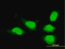 Monoclonal Anti-MSI1, (N-terminal) antibody produced in mouse clone 1B11, purified immunoglobulin, buffered aqueous solution