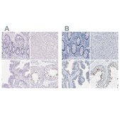 Anti-EQTN antibody produced in rabbit Prestige Antibodies® Powered by Atlas Antibodies, affinity isolated antibody, buffered aqueous glycerol solution