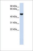 Anti-CD36 affinity isolated antibody