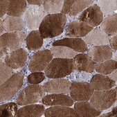 Anti-PHKA1 antibody produced in rabbit Prestige Antibodies&#174; Powered by Atlas Antibodies, affinity isolated antibody, buffered aqueous glycerol solution
