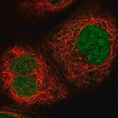 Anti-MPHOSPH6 antibody produced in rabbit Prestige Antibodies&#174; Powered by Atlas Antibodies, affinity isolated antibody, buffered aqueous glycerol solution