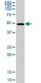 Anti-GOT1 antibody produced in rabbit purified immunoglobulin, buffered aqueous solution