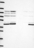 Anti-DVL1 antibody produced in rabbit Prestige Antibodies&#174; Powered by Atlas Antibodies, affinity isolated antibody, buffered aqueous glycerol solution
