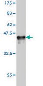 Monoclonal Anti-RAD23A antibody produced in mouse clone 3C12, purified immunoglobulin, buffered aqueous solution