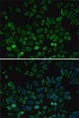 Anti-CDK4 antibody produced in rabbit