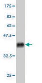 Monoclonal Anti-GRK6 antibody produced in mouse clone 2C3, purified immunoglobulin, buffered aqueous solution