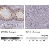 Anti-ZNF185 antibody produced in rabbit Prestige Antibodies® Powered by Atlas Antibodies, affinity isolated antibody, buffered aqueous glycerol solution