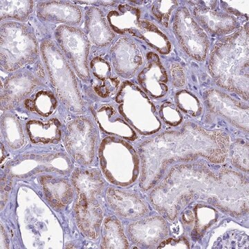 Anti-C21orf140 antibody produced in rabbit Prestige Antibodies&#174; Powered by Atlas Antibodies, affinity isolated antibody, buffered aqueous glycerol solution