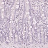 抗-LECT2 兔抗 Prestige Antibodies® Powered by Atlas Antibodies, affinity isolated antibody, buffered aqueous glycerol solution