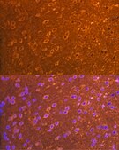 Anti-PSD93/chapsyn-110/DLG2 Antibody, clone 0G4O6, Rabbit Monoclonal