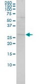 Monoclonal Anti-SH3BGR antibody produced in mouse clone 3B7, purified immunoglobulin, buffered aqueous solution