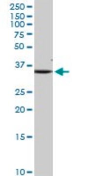 Anti-SDHB antibody produced in rabbit purified immunoglobulin, buffered aqueous solution