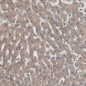 Anti-PSMA2 antibody produced in rabbit Prestige Antibodies&#174; Powered by Atlas Antibodies, affinity isolated antibody, buffered aqueous glycerol solution