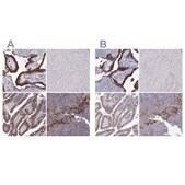 Anti-ERO1A antibody produced in rabbit Prestige Antibodies&#174; Powered by Atlas Antibodies, affinity isolated antibody, buffered aqueous glycerol solution