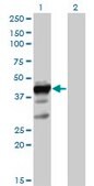Anti-ELAVL3 antibody produced in mouse IgG fraction of antiserum, buffered aqueous solution