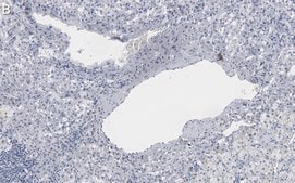 Anti-Clusterin α chain Antibody, clone 41D ZooMAb® Mouse Monoclonal recombinant, expressed in HEK 293 cells