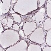 抗-WDR72 兔抗 Prestige Antibodies&#174; Powered by Atlas Antibodies, affinity isolated antibody, buffered aqueous glycerol solution