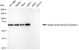 Anti Solute Carrier Family 22 Member 1 Antibody, clone 24GB2510, Rabbit Monoclonal clone 24GB2510, recombinant rabbit monoclonal, expressed in HEK293 cells