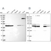 Anti-SUCLA2 antibody produced in rabbit Prestige Antibodies&#174; Powered by Atlas Antibodies, affinity isolated antibody