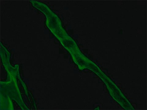 Monoclonal Anti-Titin antibody produced in mouse clone T11, ascites fluid