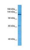 Anti-CASZ1 antibody produced in rabbit affinity isolated antibody