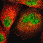 Anti-CAPNS1 antibody produced in rabbit Prestige Antibodies&#174; Powered by Atlas Antibodies, affinity isolated antibody, buffered aqueous glycerol solution