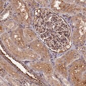 Anti-ZNF467 antibody produced in rabbit Prestige Antibodies® Powered by Atlas Antibodies, affinity isolated antibody, buffered aqueous glycerol solution