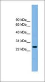Anti-TSPAN4 antibody produced in rabbit affinity isolated antibody