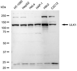 Anti ULK1 Antibody, clone 24GB2195, Rabbit Monoclonal clone 24GB2195, recombinant rabbit monoclonal, expressed in HEK293 cells