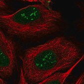 Anti-TSEN15 antibody produced in rabbit Prestige Antibodies&#174; Powered by Atlas Antibodies, affinity isolated antibody, buffered aqueous glycerol solution
