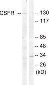 Anti-CSFR antibody produced in rabbit affinity isolated antibody