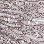 抗-PRUNE2 兔抗 Prestige Antibodies® Powered by Atlas Antibodies, affinity isolated antibody, buffered aqueous glycerol solution