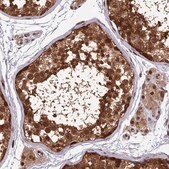 Anti-FAM53C antibody produced in rabbit Prestige Antibodies® Powered by Atlas Antibodies, affinity isolated antibody, buffered aqueous glycerol solution