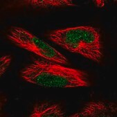 Anti-POLR3C antibody produced in rabbit Prestige Antibodies&#174; Powered by Atlas Antibodies, affinity isolated antibody, buffered aqueous glycerol solution, ab2