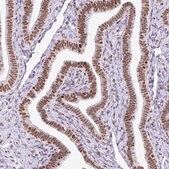 Anti-RARG antibody produced in rabbit Prestige Antibodies® Powered by Atlas Antibodies, affinity isolated antibody, buffered aqueous glycerol solution