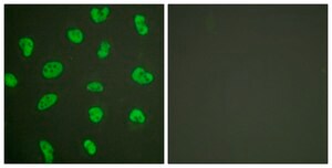 Anti-DNA-PK antibody produced in rabbit affinity isolated antibody