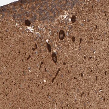 Anti-SYNRG antibody produced in rabbit Prestige Antibodies&#174; Powered by Atlas Antibodies, affinity isolated antibody, buffered aqueous glycerol solution, Ab1