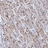 Anti-TMX2 antibody produced in rabbit Prestige Antibodies&#174; Powered by Atlas Antibodies, affinity isolated antibody, buffered aqueous glycerol solution