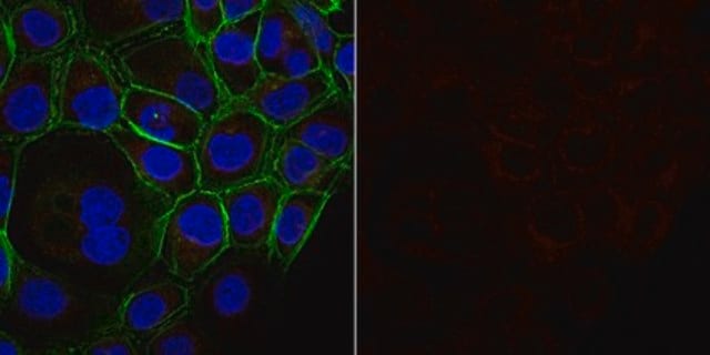 Anti-Cortactin (p80/85) Antibody, clone 4F11, Alexa Fluor&#8482; 647 Conjugate clone 4F11, from mouse, ALEXA FLUOR&#8482; 647