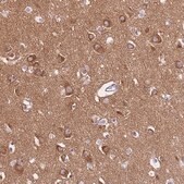 Anti-PPFIA3 antibody produced in rabbit Prestige Antibodies&#174; Powered by Atlas Antibodies, affinity isolated antibody, buffered aqueous glycerol solution