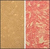 Human Coronary Artery Smooth Muscle Cells: HCASMC, adult