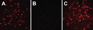 Autofluorescence Eliminator Reagent Autofluorescence Eliminator Reagent for IHC.