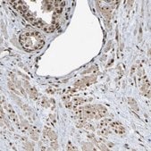 Anti-HDAC2 antibody produced in rabbit affinity isolated antibody, buffered aqueous glycerol solution