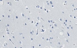 Anti-NOVA2 Antibody, clone 2J16 ZooMAb&#174; Rabbit Monoclonal recombinant, expressed in HEK 293 cells