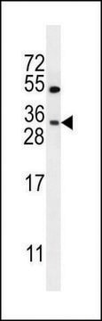 ANTI-LOC284422 (C-TERM) antibody produced in rabbit IgG fraction of antiserum, buffered aqueous solution