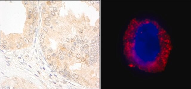 Rabbit anti-cAbl Antibody, Affinity Purified Powered by Bethyl Laboratories, Inc.